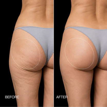 Neravio EMS Toning Shorts
